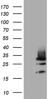 Monoclonal Mouse anti-Human DIRAS2 Antibody (clone OTI8A5, aa1-196, IHC, WB)