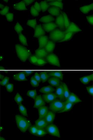 CAMK1 / CAMKI Antibody