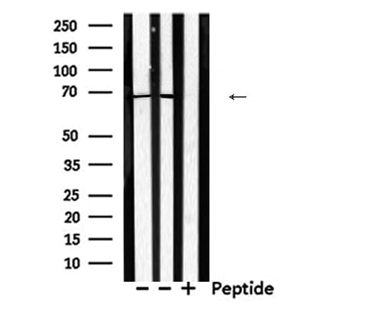 DDX5 Antibody