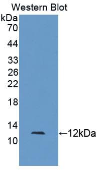 S100A5 Antibody (aa1-93)