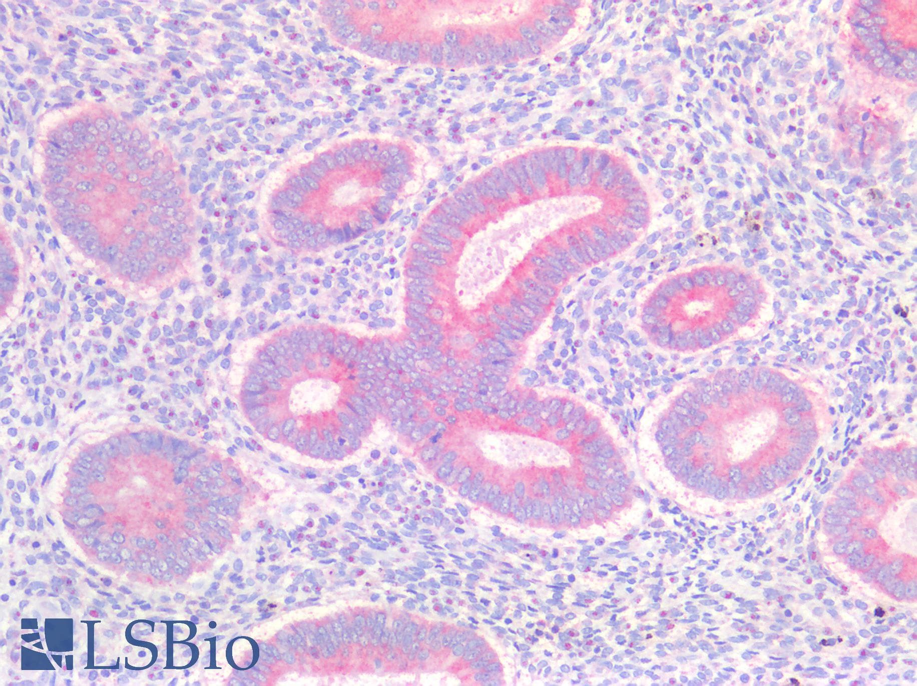 PathPlus™ IGF2 Antibody (aa81-93)