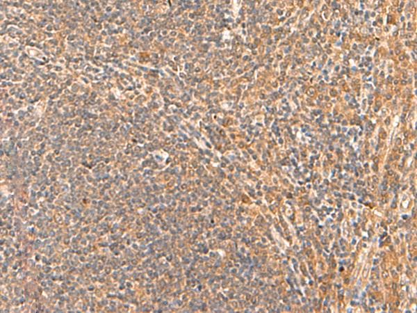 HPCA / Hippocalcin Antibody