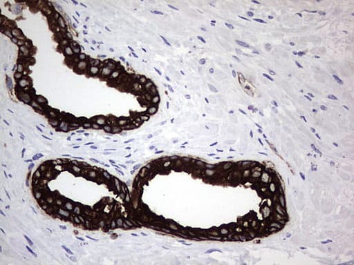 Monoclonal Rat anti-Human Acidic Cytokeratin Antibody (clone 9H3, IHC)