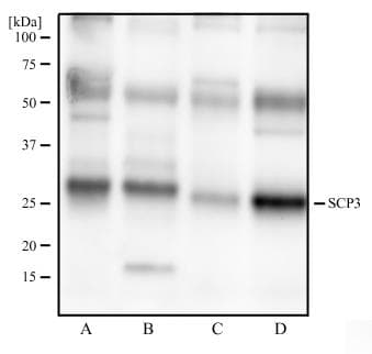 SYCP3 / SCP3 Antibody (aa1-200, clone 6F9C5)