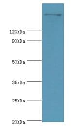 TRPM2 Antibody (aa1204-1503)