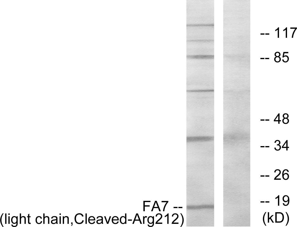 F7 / Factor VII Antibody (light chain, Cleaved-Arg212)