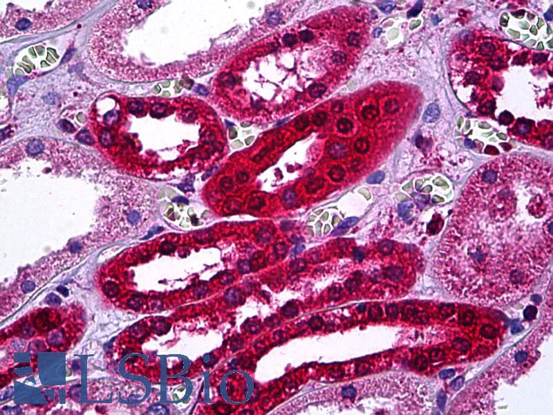 IHC-plus™ Monoclonal Mouse anti-Human AKR1B1 / Aldose Reductase Antibody (clone 2D12, IHC, WB)