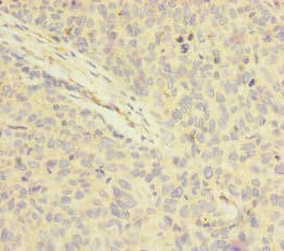 FOXRED1 Antibody