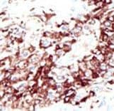 HDAC11 Antibody (aa1-30)