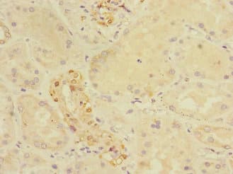 Polyclonal Rabbit anti-Human CRIP1 Antibody (IHC, WB)