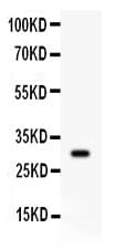 Polyclonal Rabbit anti-Human CD8A / CD8 Alpha Antibody (aa22-187, IHC, WB)