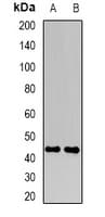 Polyclonal Rabbit anti-Human FBXO22 Antibody (WB)