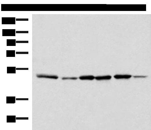Polyclonal Rabbit anti-Human IP6K1 Antibody (IHC, WB)