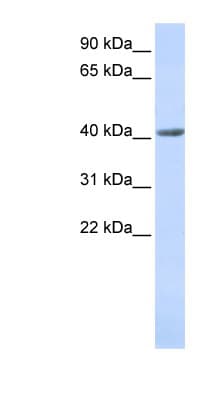 SMYD3 Antibody (aa36-85)
