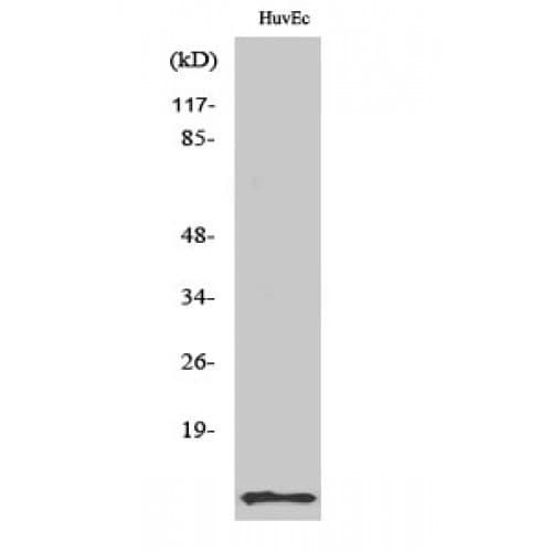 Polyclonal Rabbit anti-Human DBI / ACBD1 Antibody (Internal, IHC, WB)
