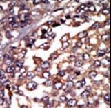 PRKAR1A Antibody (aa1-30)