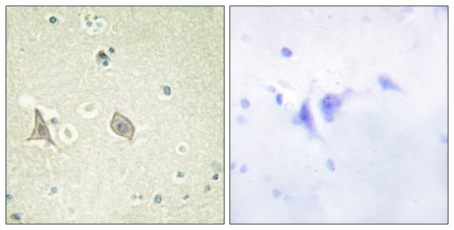 Polyclonal Rabbit anti-Human CSF1R / CD115 / FMS Antibody (phospho-Tyr723, IHC, WB)