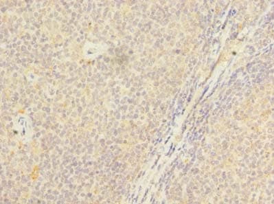 PSTPIP2 Antibody