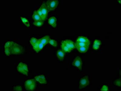 VRL1 / TRPV2 Antibody