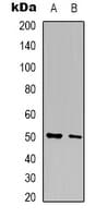 PHYKPL / AGXT2L2 Antibody (C-Terminus)