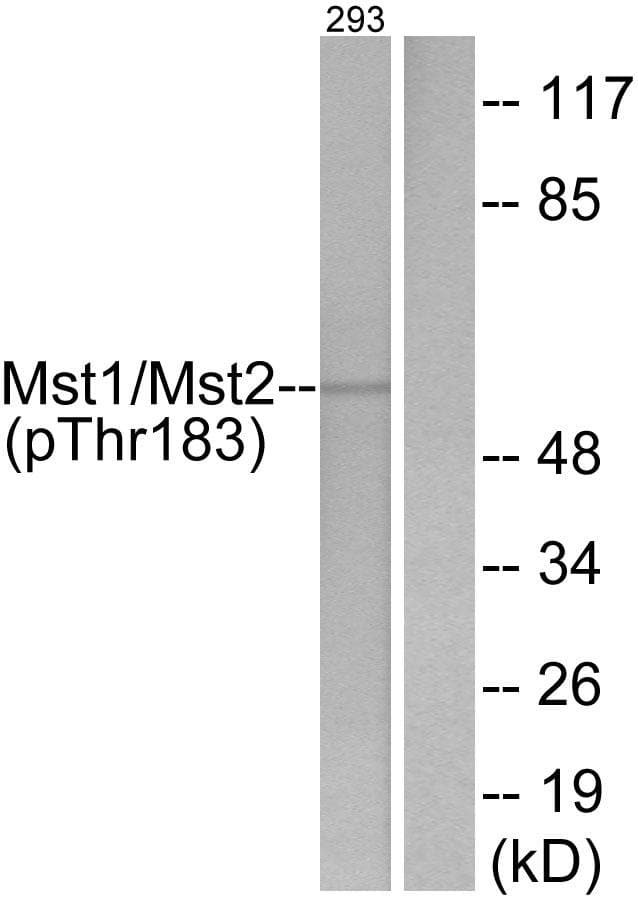 STK4 Antibody (phospho-Thr183)