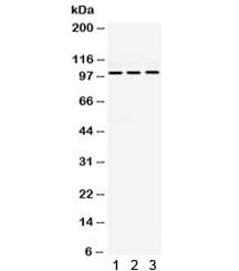 Polyclonal Rabbit anti-Human RASA1 Antibody (WB)