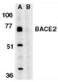 PathPlus™ Polyclonal Rabbit anti-Human BACE2 Antibody (IHC, WB)