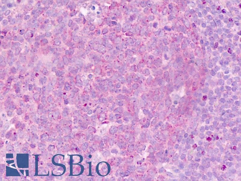 IHC-plus™ CDH7 / Cadherin 7 Antibody (aa56-84)