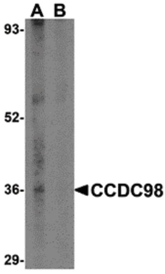 FAM175A / CCDC98 Antibody