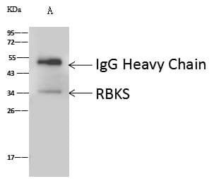 RBKS / Ribokinase Antibody (Preservative Free)