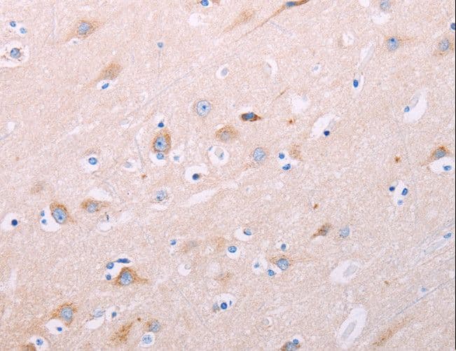 ADCY5 / Adenylate Cyclase 5 Antibody