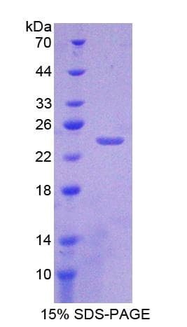 Mouse CRYGS Protein (Recombinant His-T7)