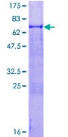 Human ATOH1 / MATH-1 Protein (Recombinant GST)