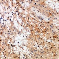 RAF1 / RAF Antibody