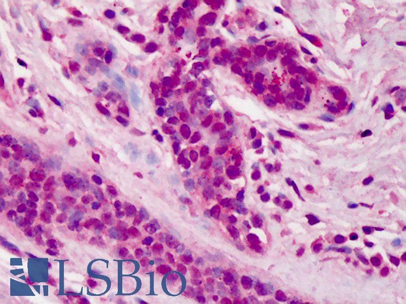 IHC-plus™ DOK1 Antibody