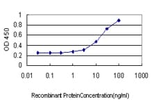IHC-plus™ PRKD2 / PKD2 Antibody (clone 2E4)