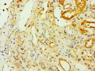 Polyclonal Rabbit anti-Human CSNK1A1L Antibody (aa1-337, IHC)