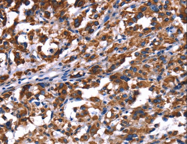 PHB / Prohibitin Antibody