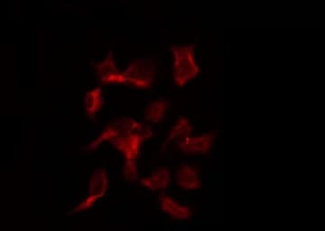 TIMP3 Antibody