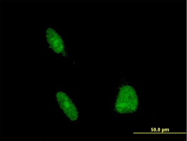 ERCC1 Antibody (clone 3A7)