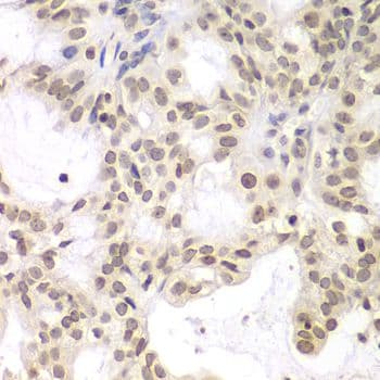 NIRF / UHRF2 Antibody