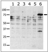 PAK6 Antibody (aa116-146)