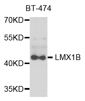 Polyclonal Rabbit anti-Human LMX1B Antibody (IHC, WB)