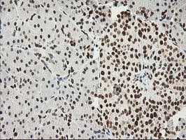 LOX / Lysyl Oxidase Antibody (clone OTI9G2)