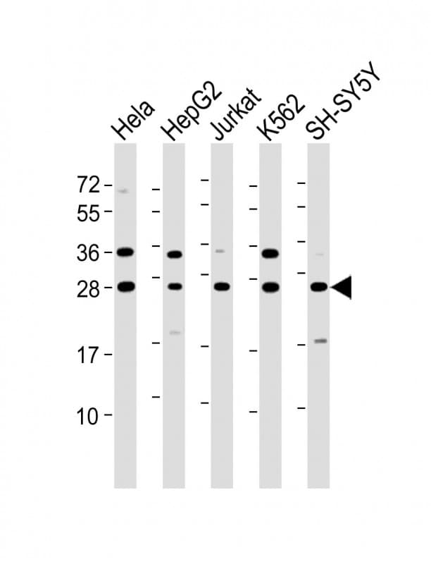 HSD17B10 / HADH2 Antibody (N-Terminus)