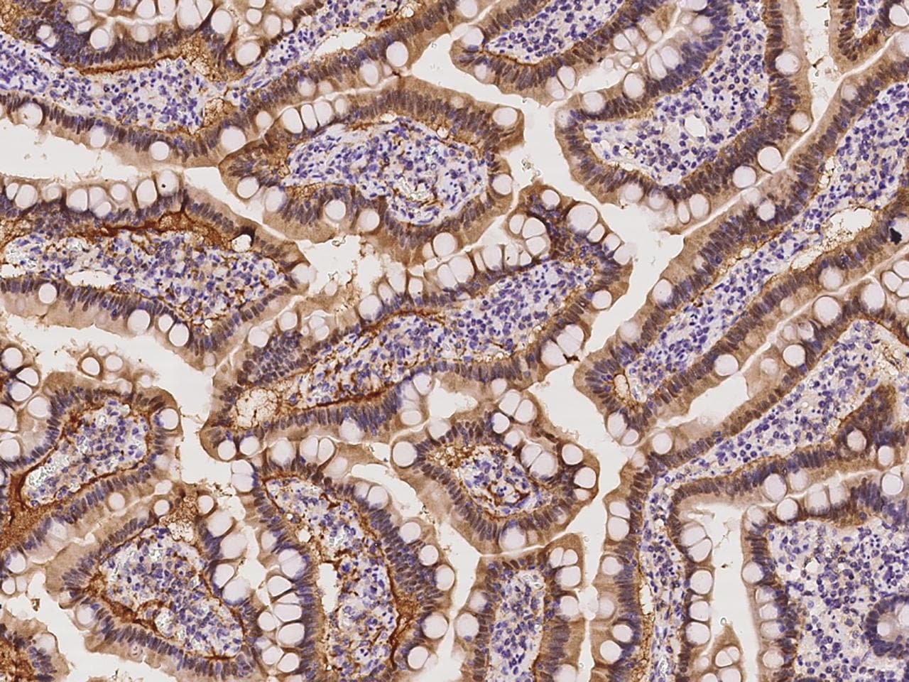 RBP2 / CRBPII Antibody