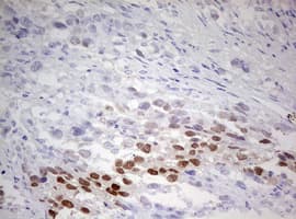 TIPIN Antibody (clone OTI3A1)