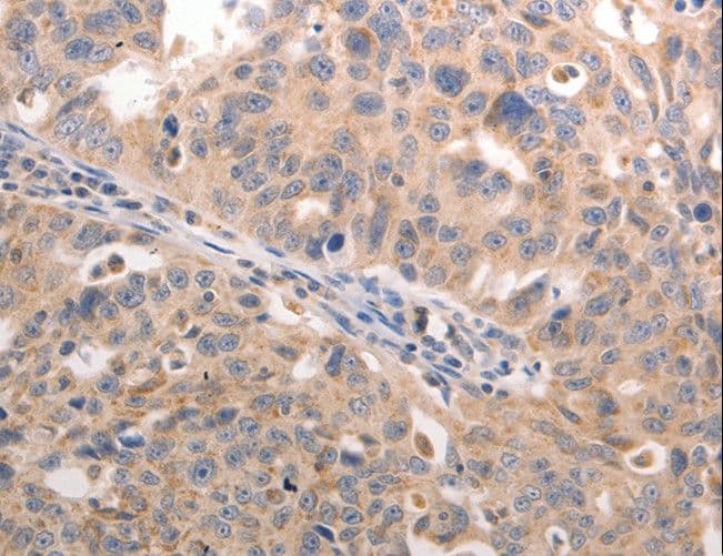 Osteocalcin Antibody