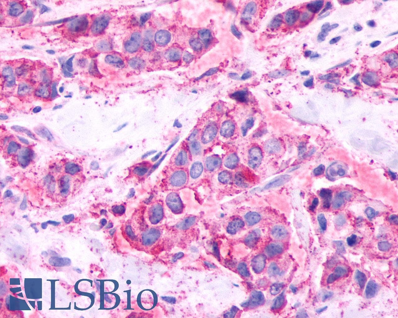 PathPlus™ Polyclonal Rabbit anti-Human GPR61 Antibody (C-Terminus, IHC)
