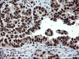 UBE2E3 Antibody (clone OTI1B4)